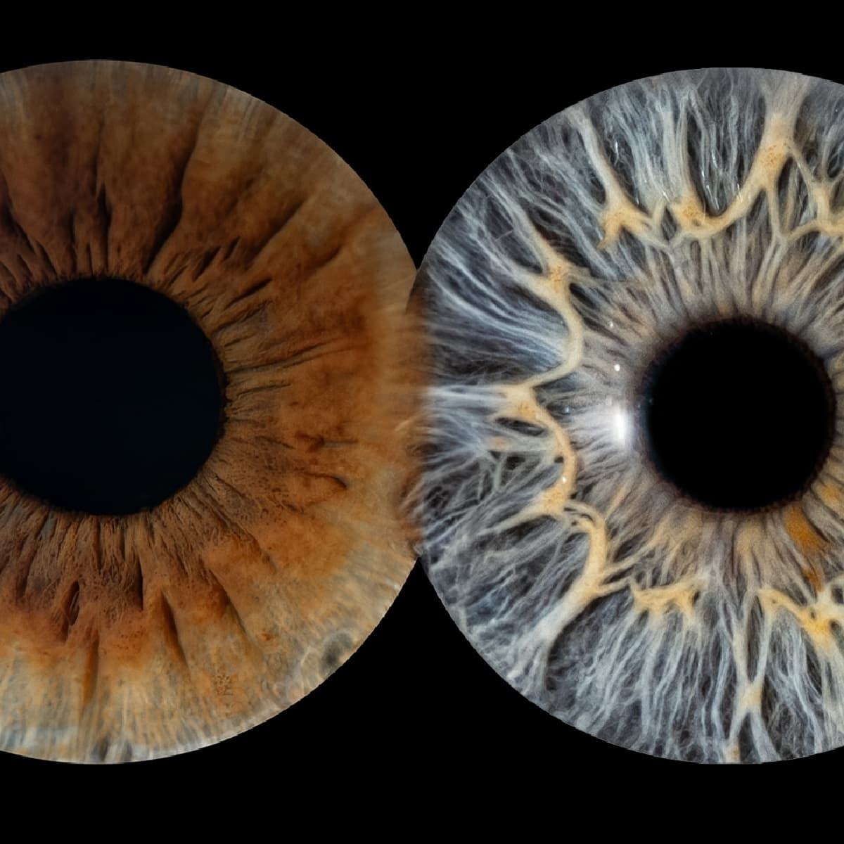 Fotografia tęczówki (mini) | Bydgoszcz