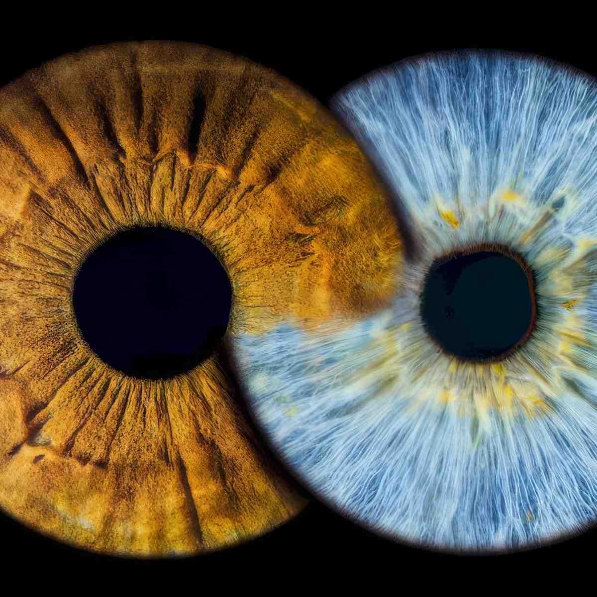 Fotografia tęczówki | Warszawa