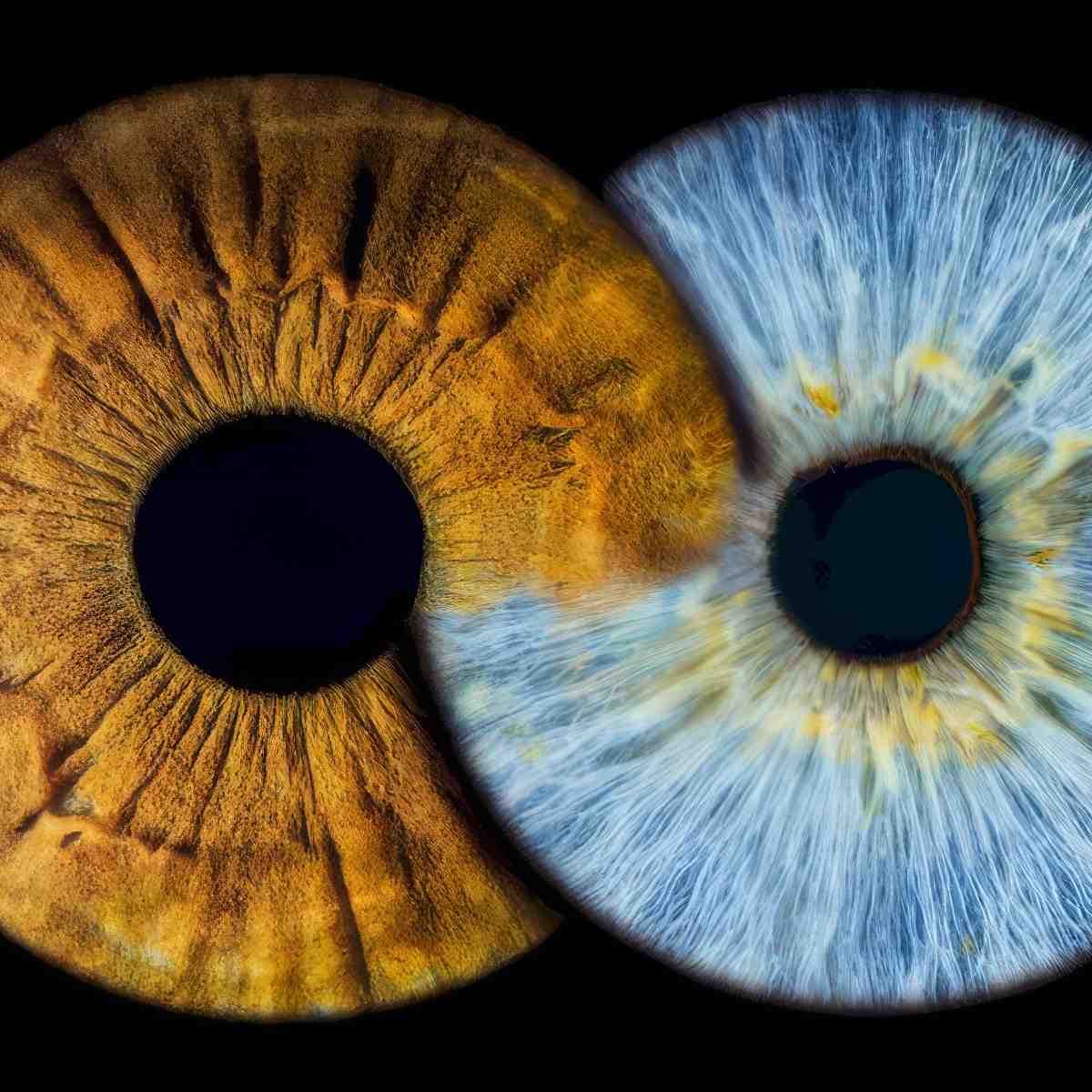 Fotografia tęczówki | Łódź