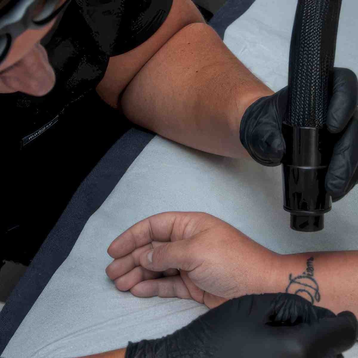 Voucher na usuwanie tatuażu | Kobyłka