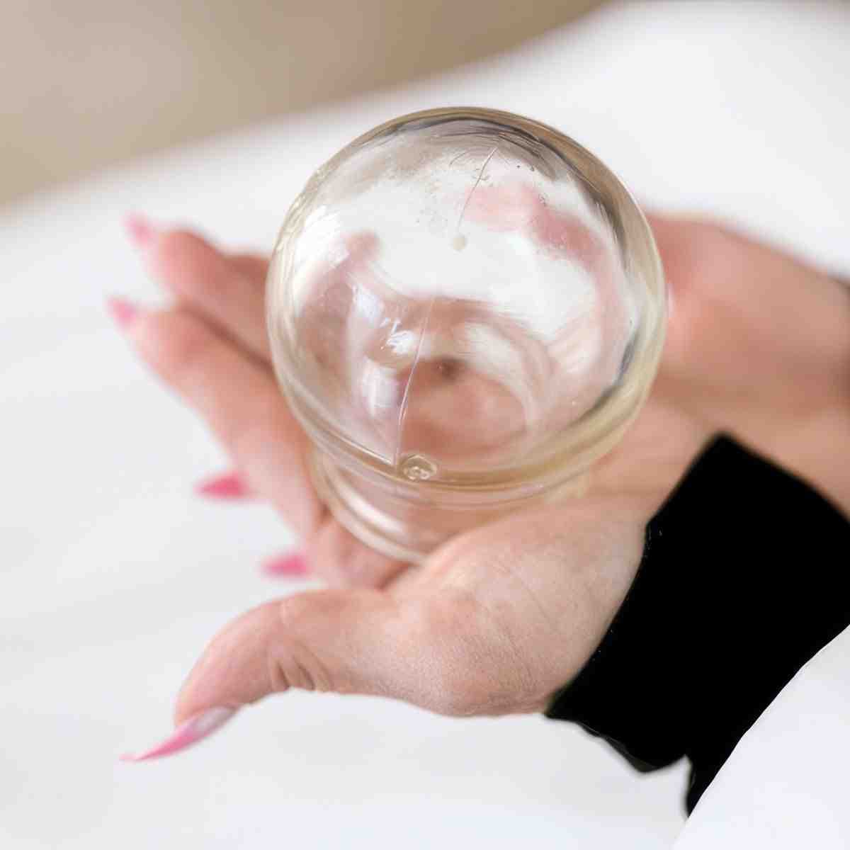 Masaż bańką chińską | Szczecin | MK Fizjoterapia Marta Korzonek