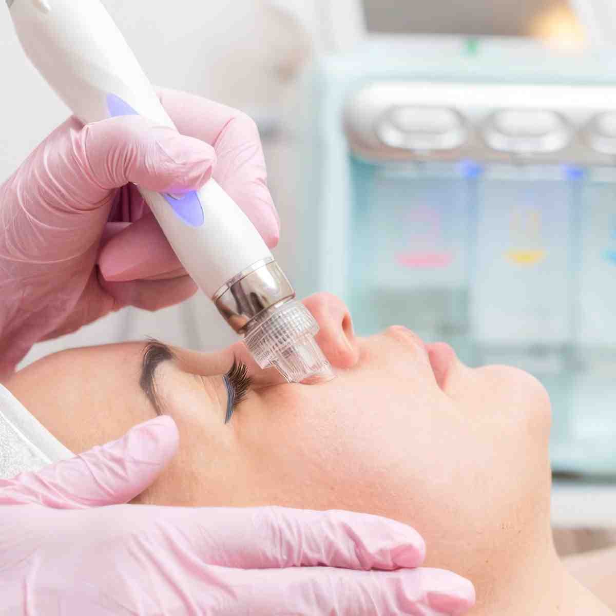 Zabieg na twarz | Toruń | Estetic World