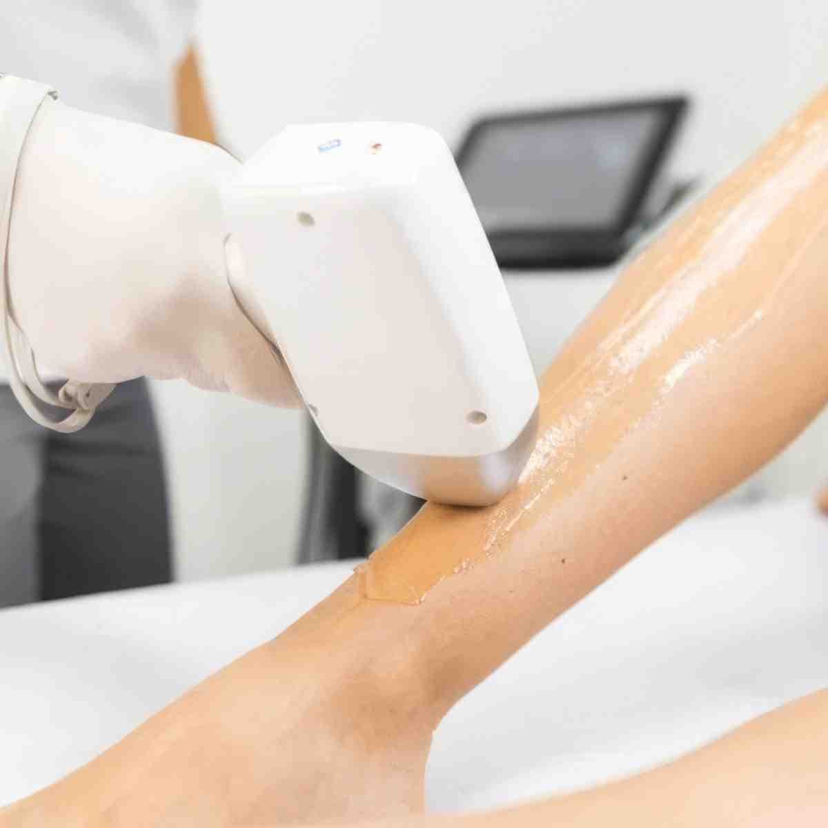 Voucher 300 PLN na depilację laserową | Toruń