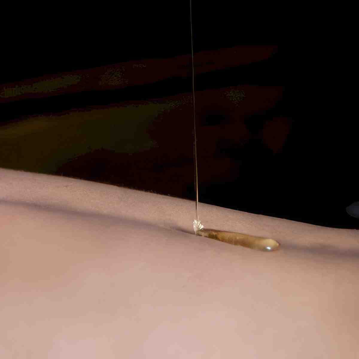 Masaż miodem | Wrocław | Estetyka Ciała