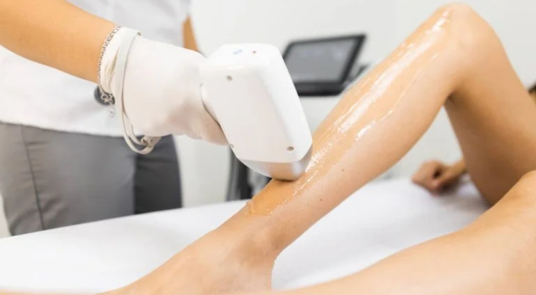 Voucher 300 PLN na depilację laserową - Toruń
